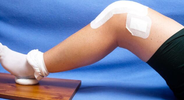Use of a therapeutic patch for arthrosis of the knee joint