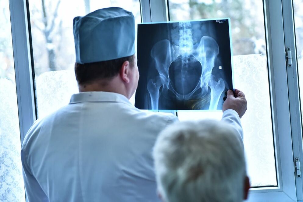 The doctor looks at the picture of the arthrosis of the hip joint