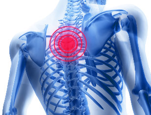 The chest pain of osteoarthritis